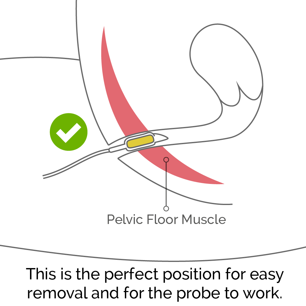 The perfect position of the probe in the body