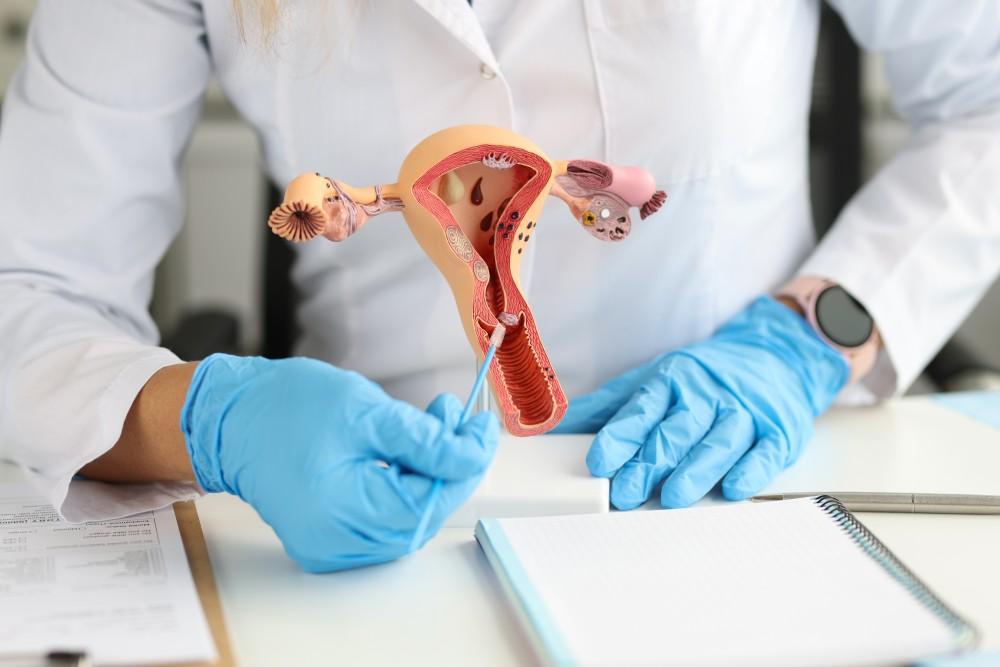 Pelvic Organ Prolapse: Causes, Symptoms & Treatment