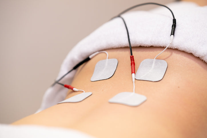 Non-Invasive Sacral Nerve Stimulation: How External Electrode Therapy Works