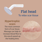 ScarGone Scar Management Massager 