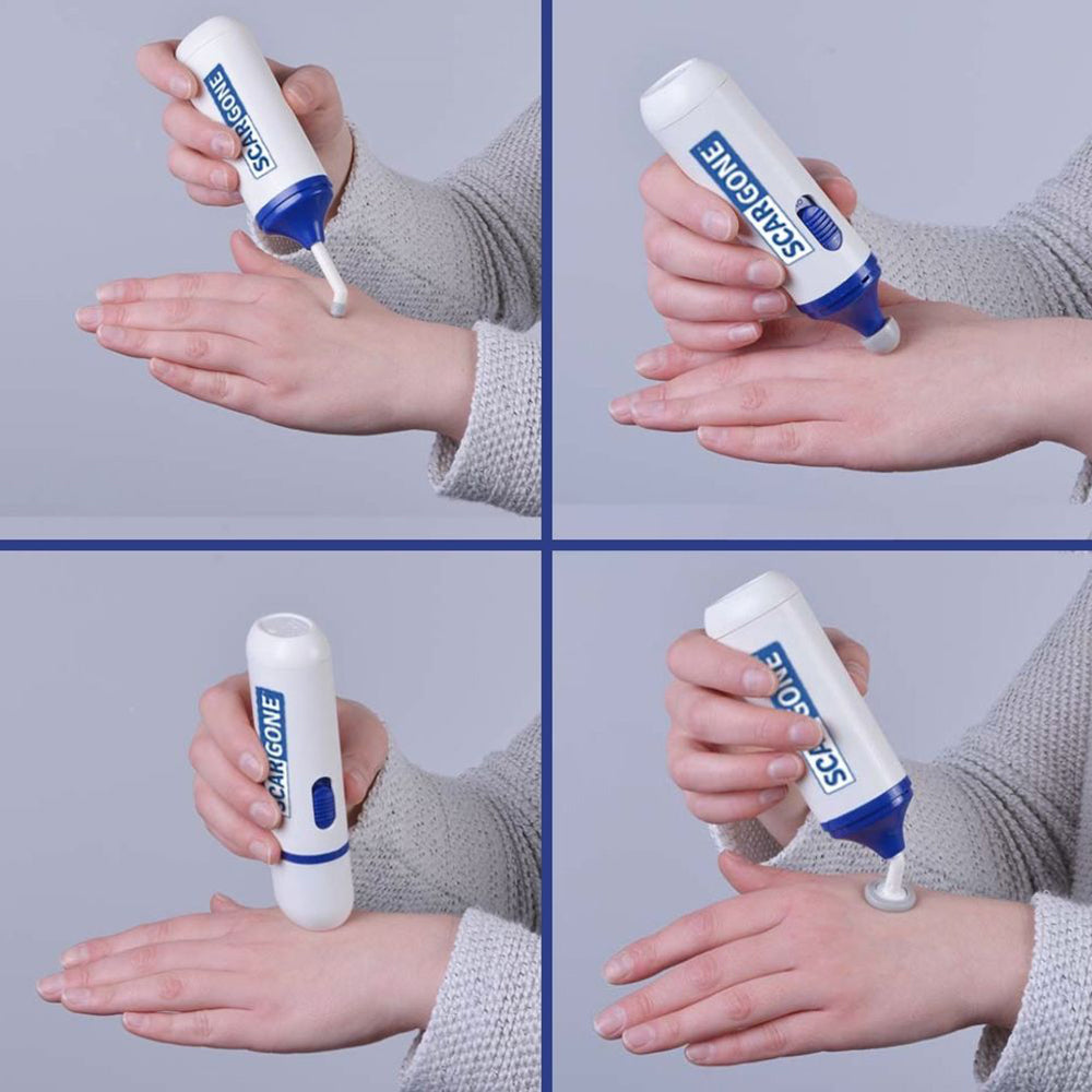 ScarGone™ Scar Management Massager & Balm Set 
