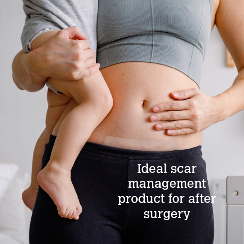 ScarGone Scar Management Set 