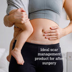 ScarGone Scar Management Set 