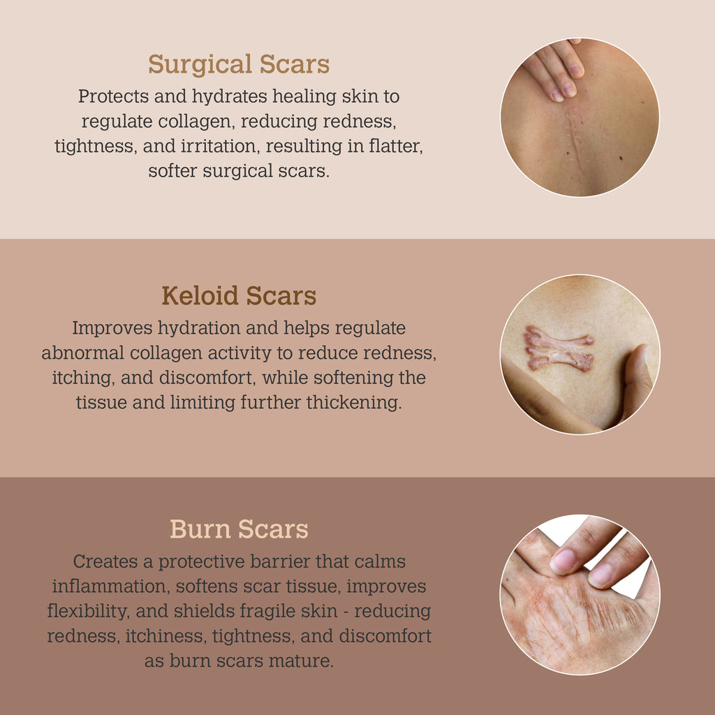 ScarGone Silicone Scar Gel