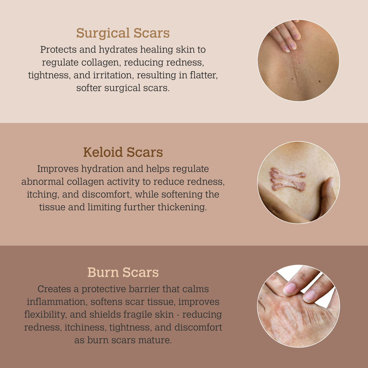 ScarGone Silicone Scar Gel