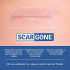 ScarGone Complete Silicone Scar Therapy Pack