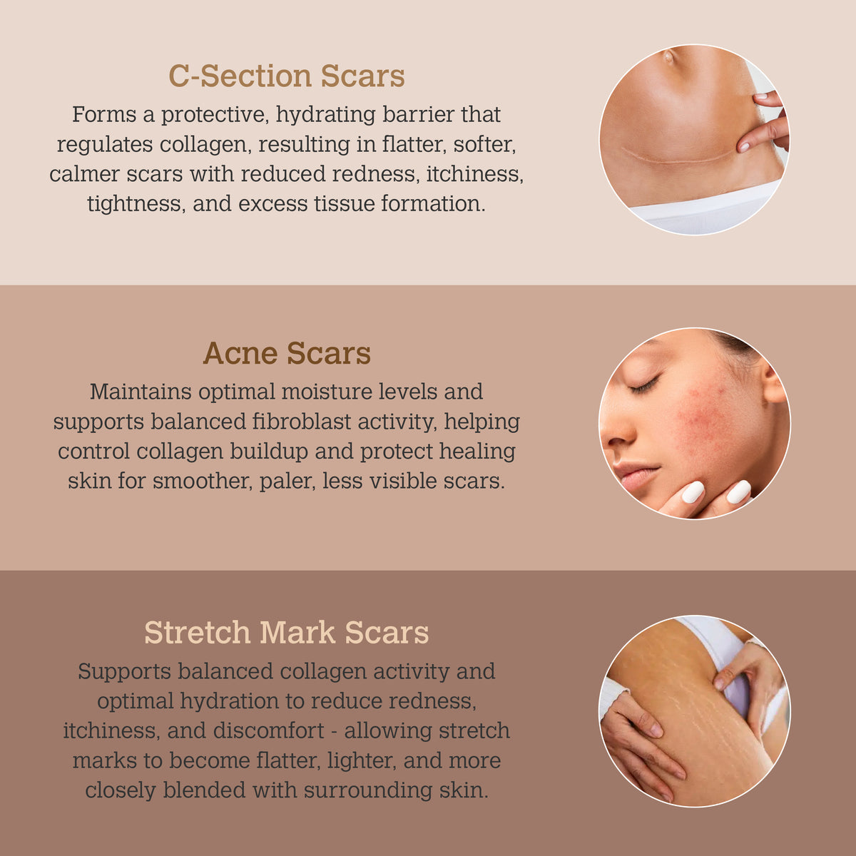 ScarGone Silicone Scar Therapy Sheets