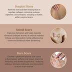 ScarGone Silicone Scar Therapy Sheets