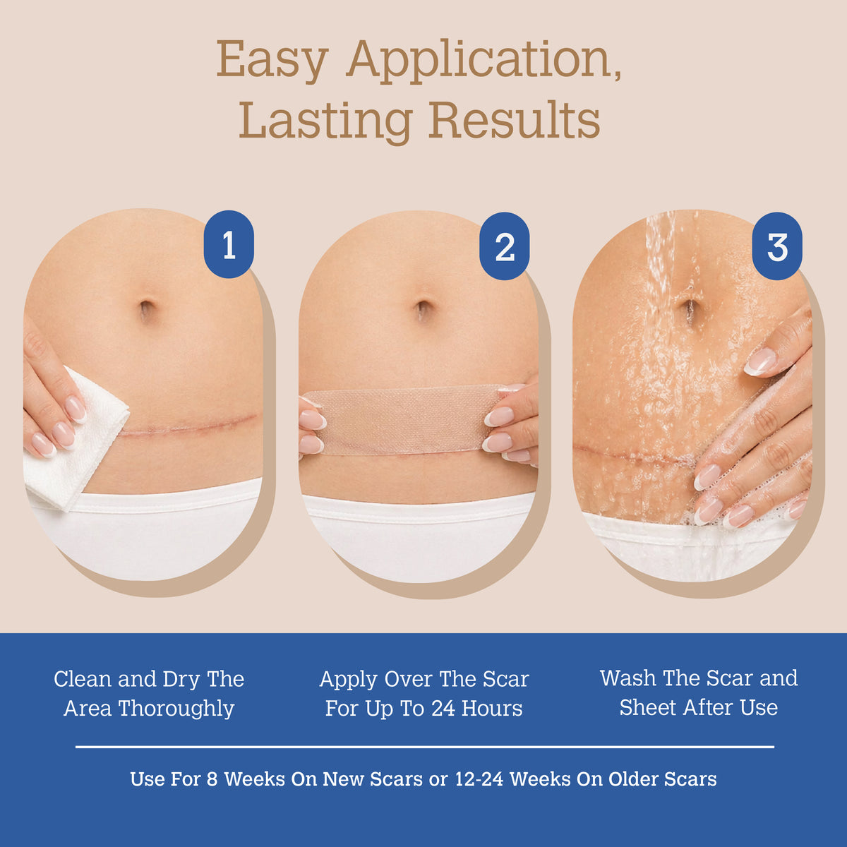 ScarGone Silicone Scar Therapy Sheets