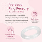 Balance Ring Pessary Without Support