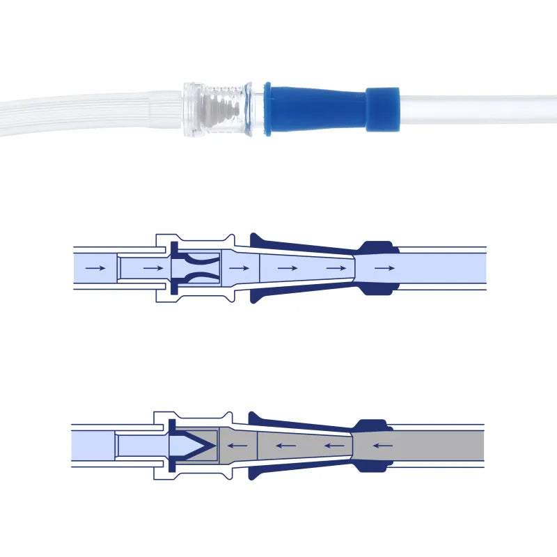 Reprop Clyster Accessories Kit — Enema Replacement Tubes & Valve