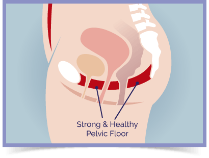 Diagram showing strong female pelvic floor muscles